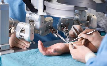robot-assisted microsurgery